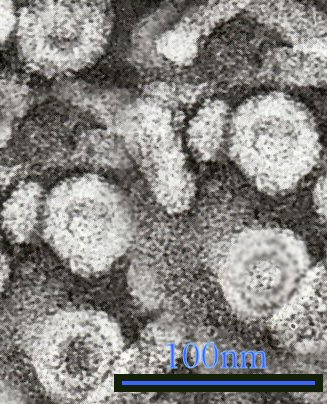 Transmission electron micrograph of Hepatitis B virus particles from blood.